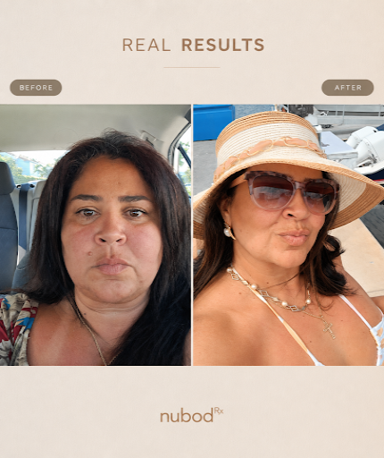  transformation
